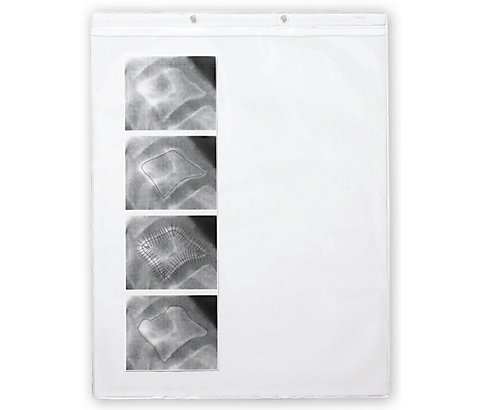 These vinyl pockets make things crystal clear. Safeguard important records, photos & X-rays.